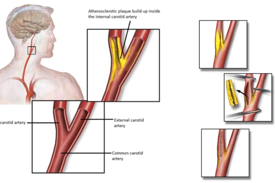 vascular surgeon Cape Town, vascular surgeons in cape town, vascular surgeons, vascular specialists cape town, vein doctors, vein doctors Cape Town