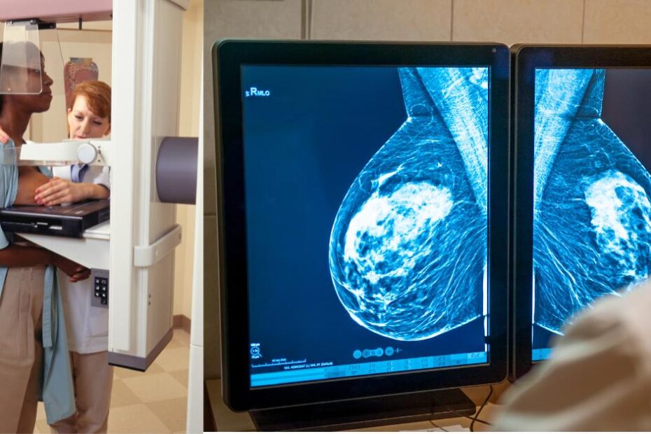 Mammograms blog post featured image