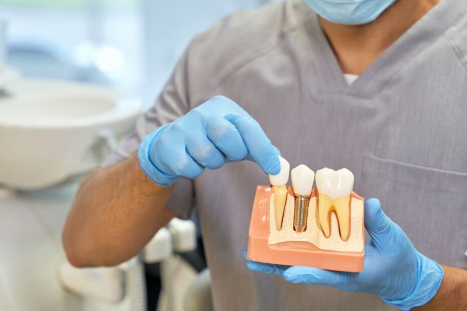 Dental implants