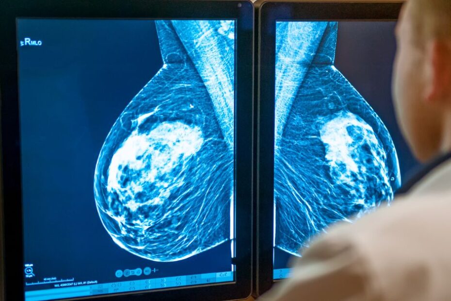 Breast Health Mammograms