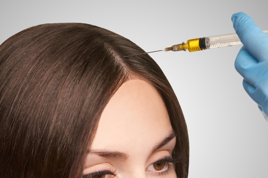 PRP Hair Treatment ()