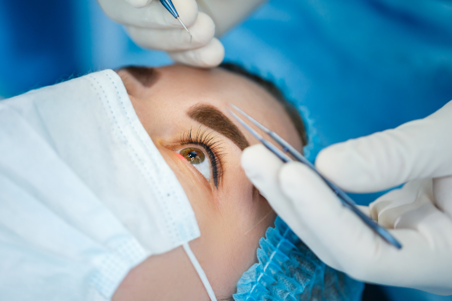 What You Should Know About Eye Surgery and Vision Correction