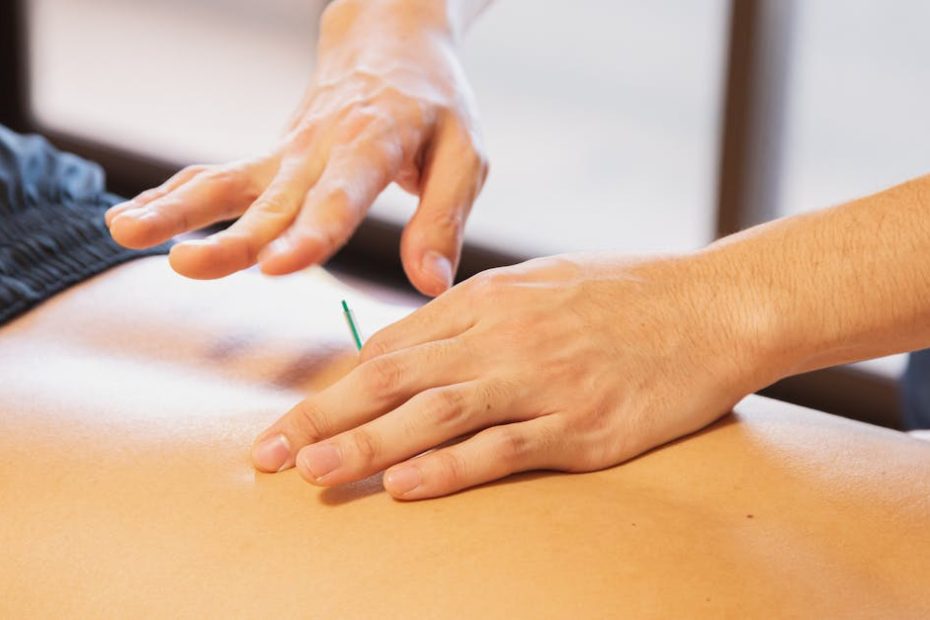 Crop anonymous male doctor putting needles on back during acupuncture therapy session in rehabilitation salon