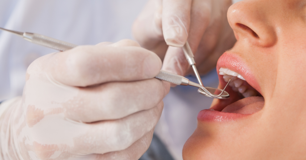 How To Choose The Right Dentist In Sandton