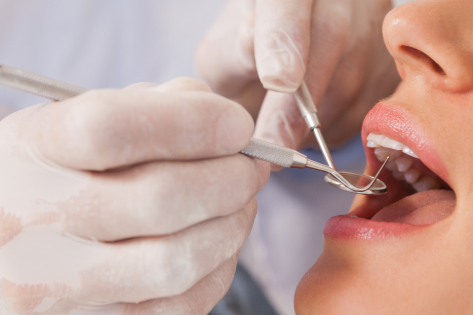 How To Choose The Right Dentist In Sandton
