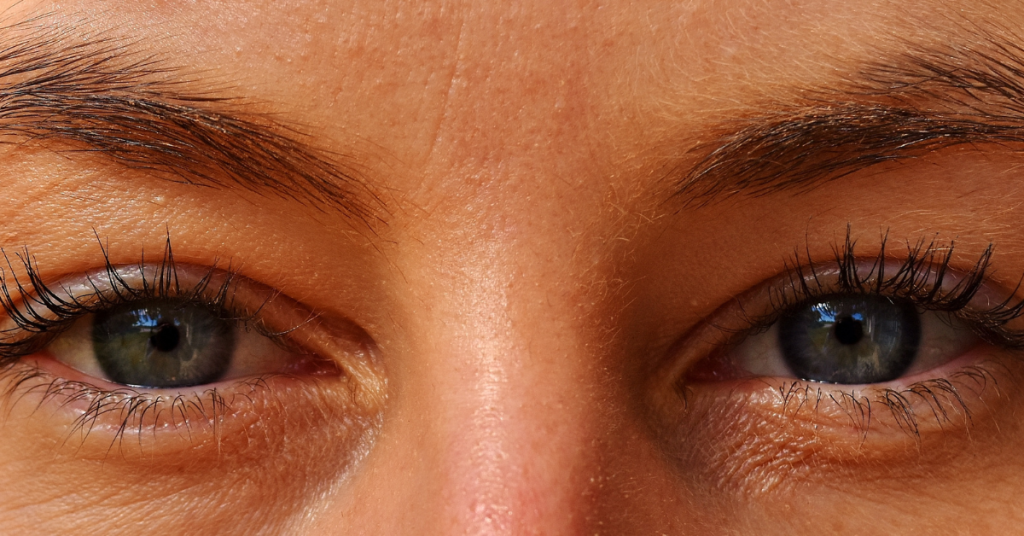 Understanding Eye Care and Vision Surgery in South Africa